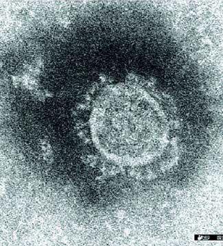 新型コロナウイルスの電子顕微鏡写真